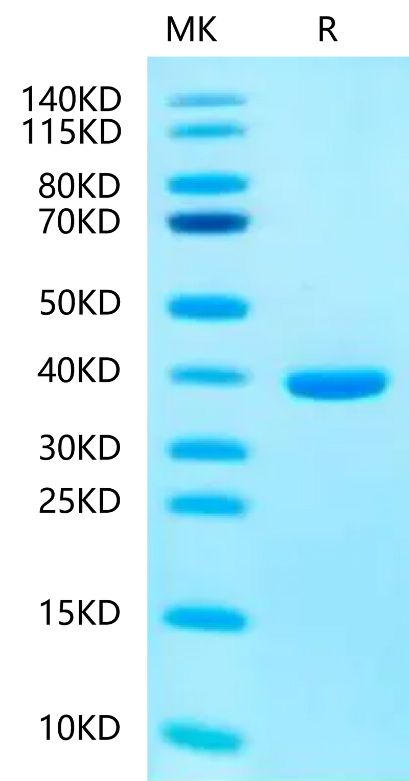 Human SMR3B on Tris-Bis PAGE under reduced condition. The purity is greater than 95%.Recombinant Human SMR3B-Protein