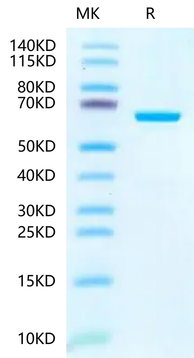 Human IGFBP-7 on Tris-Bis PAGE under reduced condition. The purity is greater than 95%.Recombinant Human IGFBP-7 Protein, Active