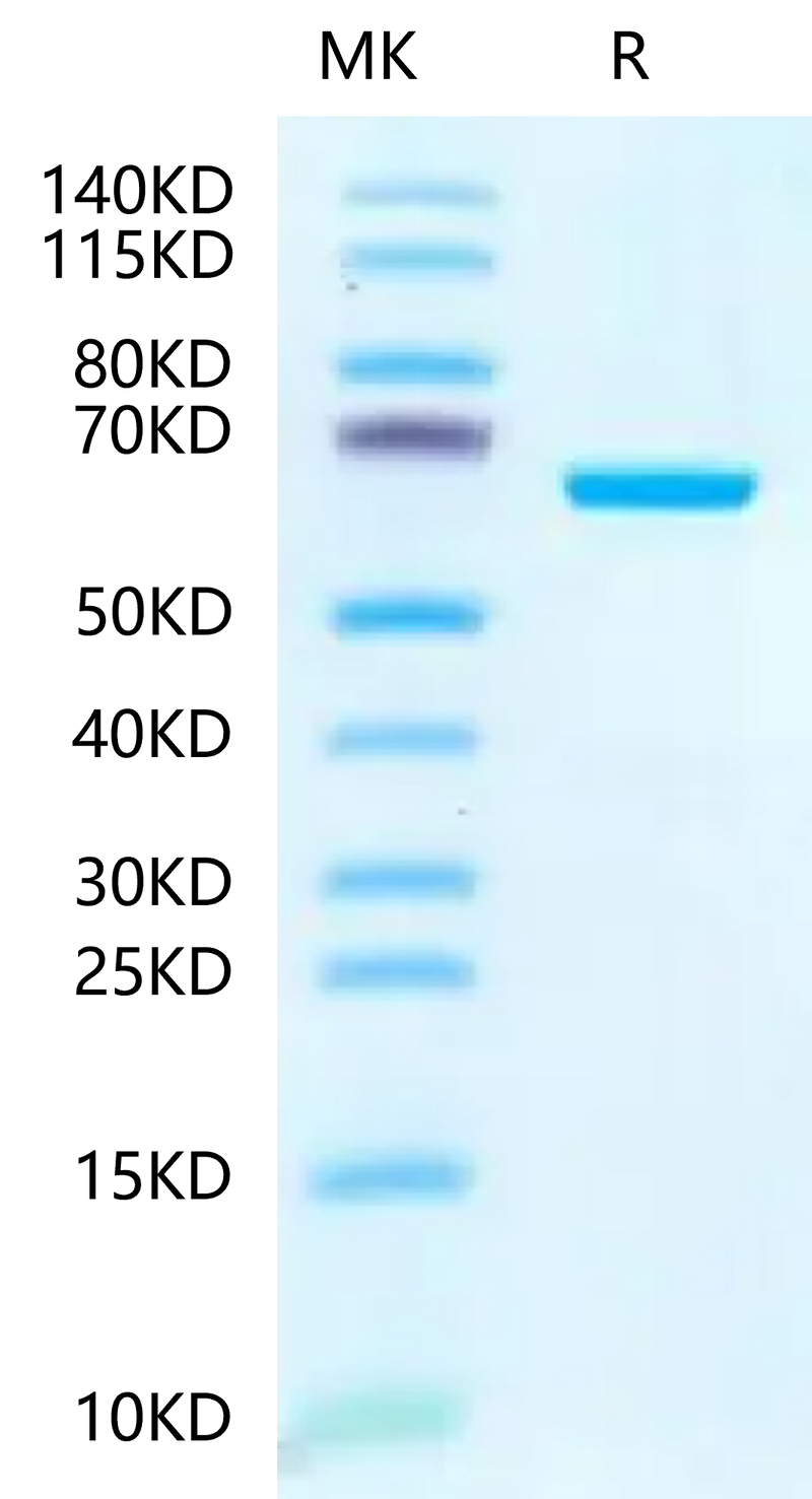Human IGFBP-7 on Tris-Bis PAGE under reduced condition. The purity is greater than 95%.Recombinant Human IGFBP-7 Protein, Active