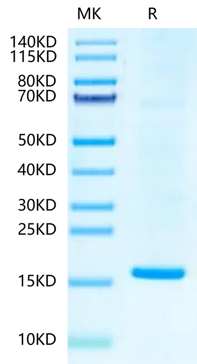 HBV (ayw/France/Tiollais/1979) Capsid on Tris-Bis PAGE under reduced condition. The purity is greater than 95%.Recombinant Hepatitis B Virus (HBV) (ayw/France/Tiollais/1979) Capsid-Protein