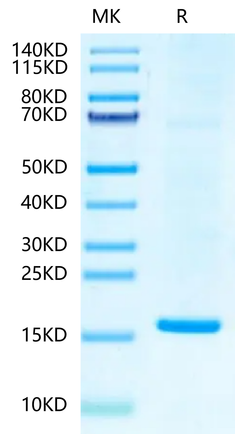 HBV (ayw/France/Tiollais/1979) Capsid on Tris-Bis PAGE under reduced condition. The purity is greater than 95%.Recombinant Hepatitis B Virus (HBV) (ayw/France/Tiollais/1979) Capsid-Protein