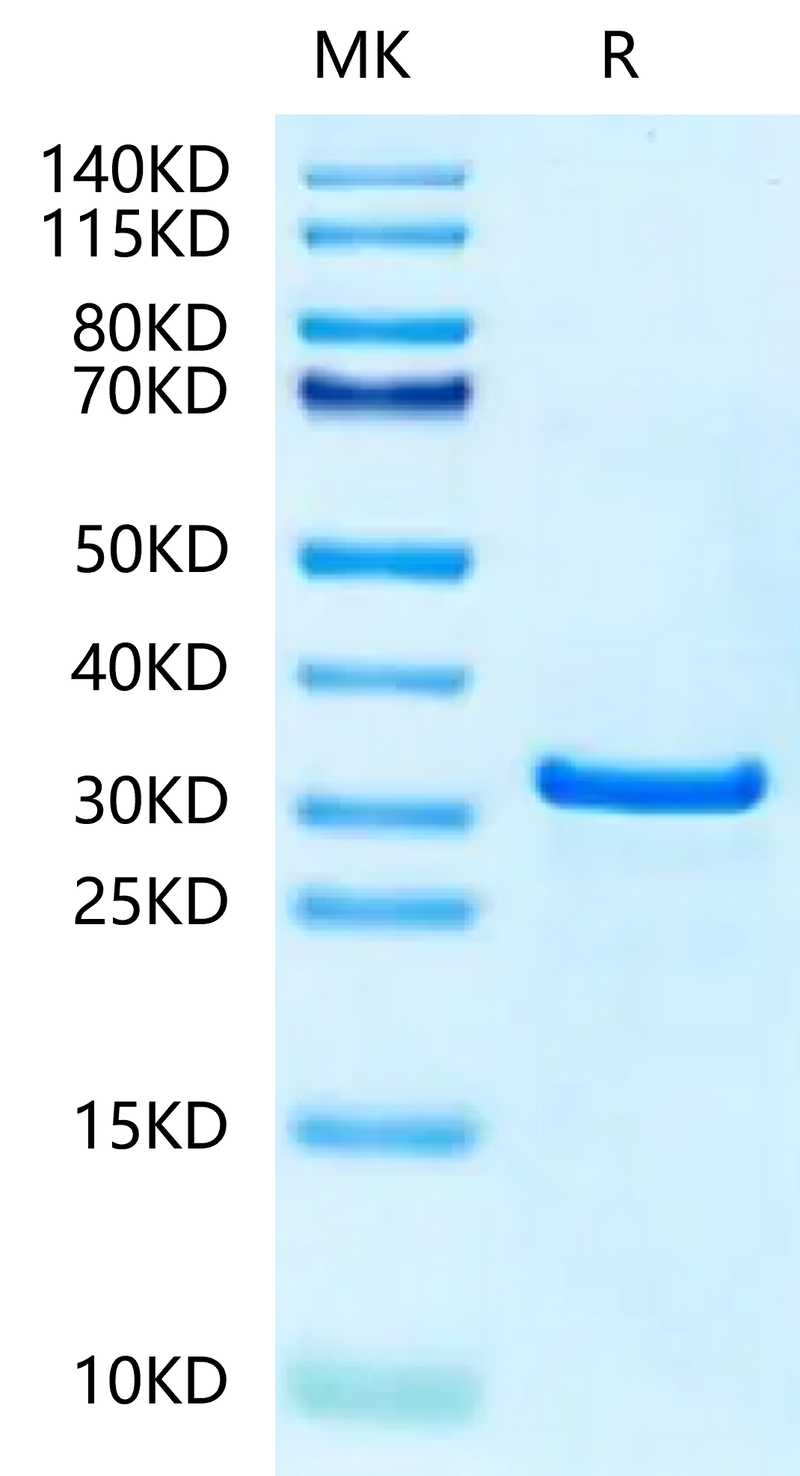 Human NUDT5 on Tris-Bis PAGE under reduced condition. The purity is greater than 95%.Recombinant Human NUDT5 Protein