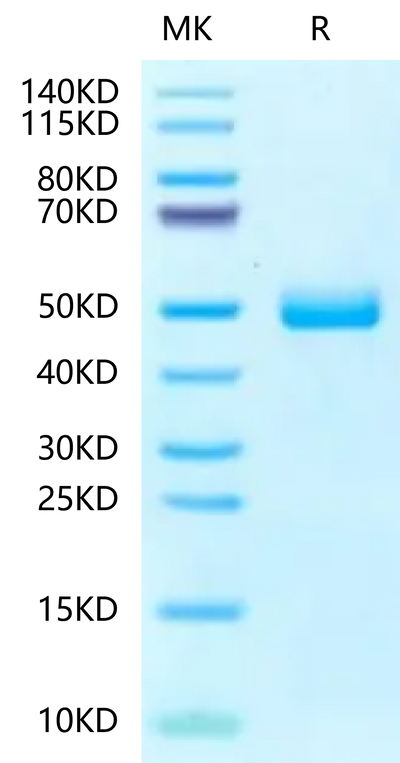 Human Fibronectin (1266-1356) on Tris-Bis PAGE under reduced condition. The purity is greater than 95%.Recombinant Human Fibronectin (1266-1356) Protein