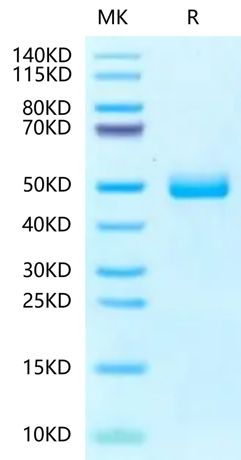 Human Fibronectin (1266-1356) on Tris-Bis PAGE under reduced condition. The purity is greater than 95%.Recombinant Human Fibronectin (1266-1356) Protein