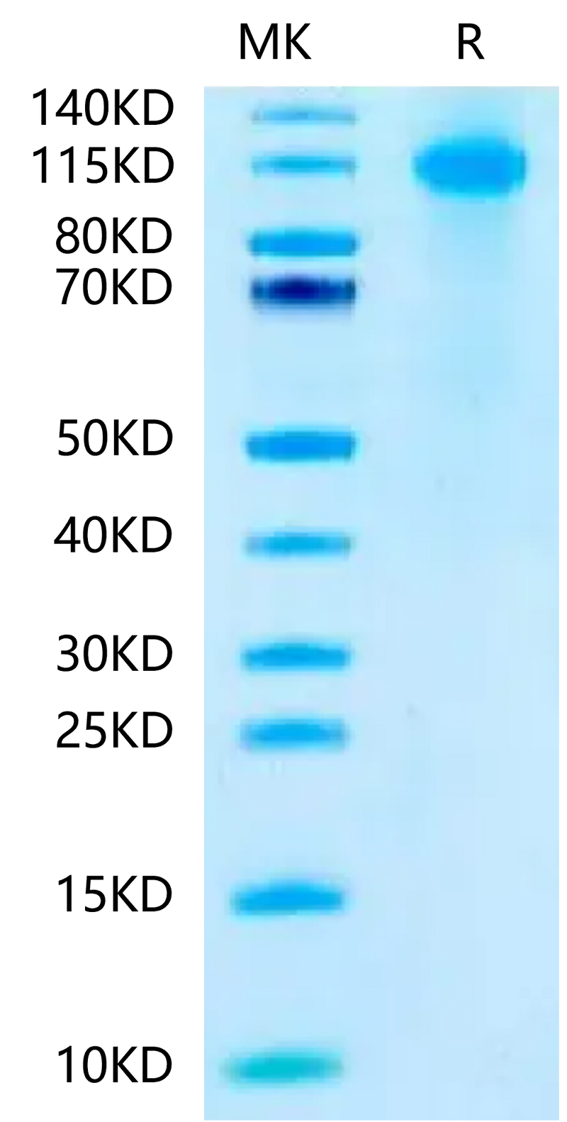 Biotinylated Human FcRH5 on Tris-Bis PAGE under reduced condition. The purity is greater than 95%.Biotinylated Human FcRH5/FcRL5 Protein (Primary Amine Labeling), Active