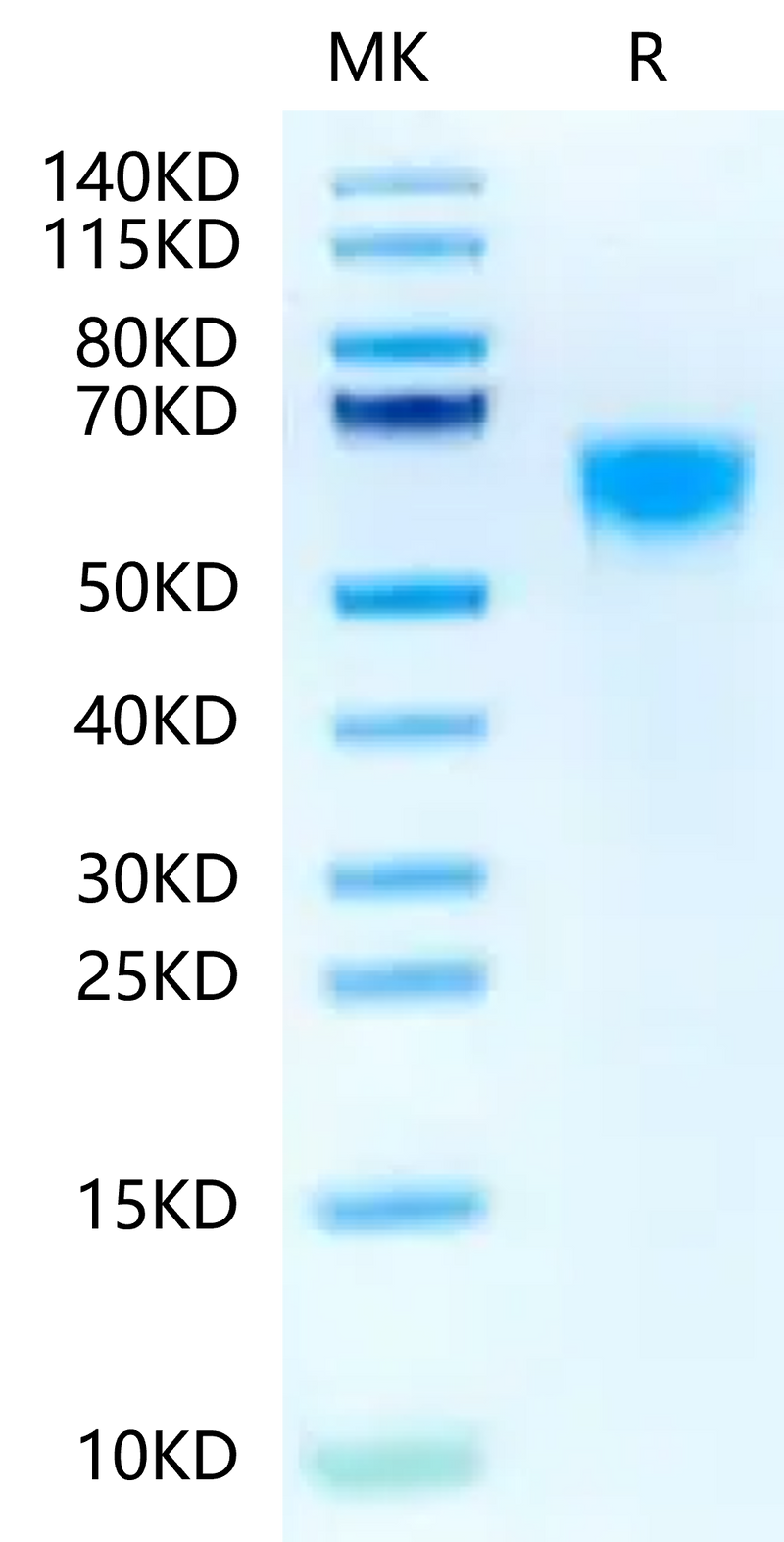 Biotinylated Human IL-3 R alpha on Tris-Bis PAGE under reduced condition. The purity is greater than 95%.Biotinylated Human IL-3 R alpha/CD123 Protein, Active