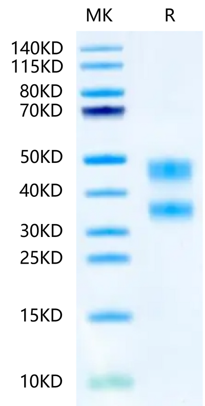 Mouse CD8 alpha&beta Heterodimer on Tris-Bis PAGE under reduced condition. The purity is greater than 95%.Recombinant Mouse CD8 alphaβ Heterodimer Protein