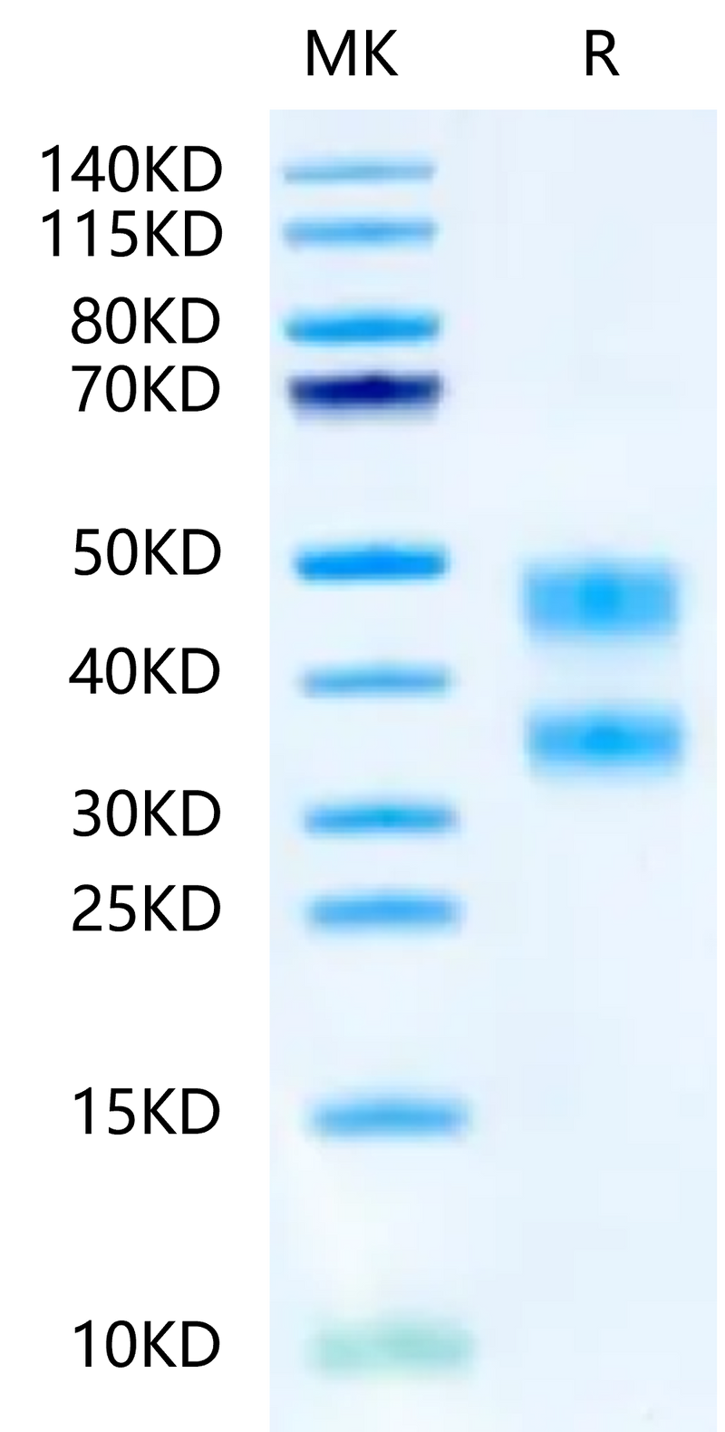 Mouse CD8 alpha&beta Heterodimer on Tris-Bis PAGE under reduced condition. The purity is greater than 95%.Recombinant Mouse CD8 alphaβ Heterodimer Protein