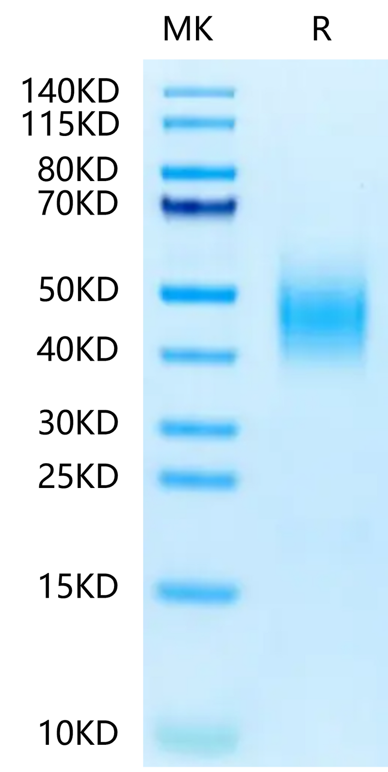 Human CD300A on Tris-Bis PAGE under reduced condition. The purity is greater than 95%.Recombinant Human CD300A Protein, Active