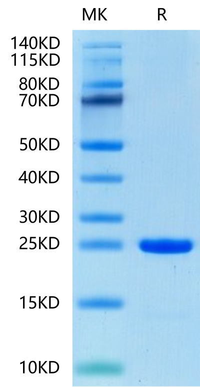 Human FGF8b-on Tris-Bis PAGE under reduced condition. The purity is greater than 95%.Recombinant Human FGF8b-Protein