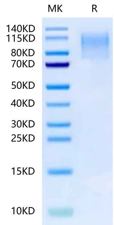 Mouse CD43 on Tris-Bis PAGE under reduced condition. The purity is greater than 95%.Recombinant Mouse CD43 Protein