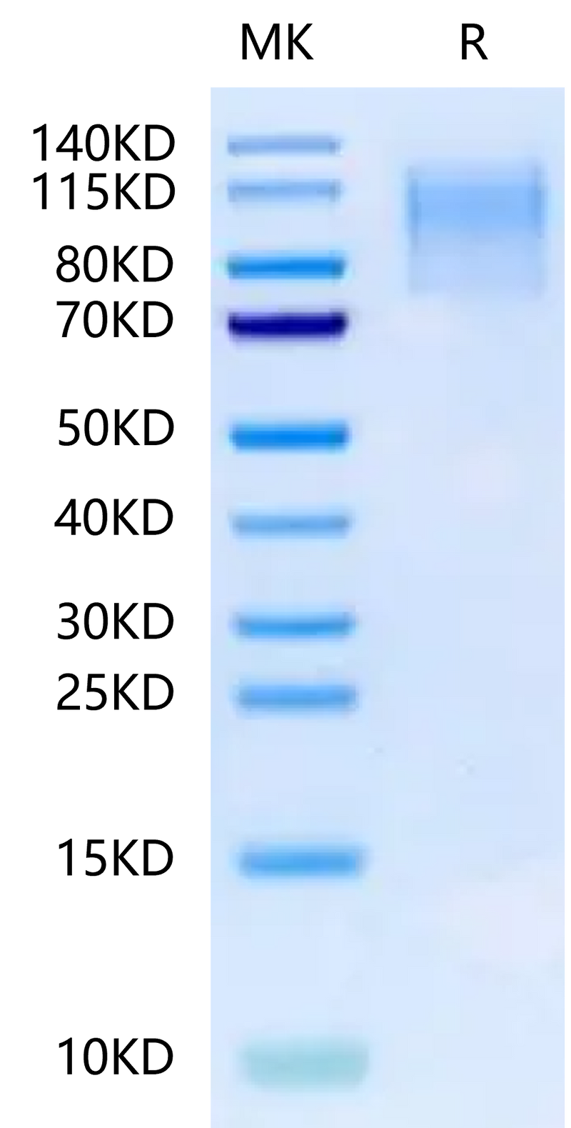 Mouse CD43 on Tris-Bis PAGE under reduced condition. The purity is greater than 95%.Recombinant Mouse CD43 Protein
