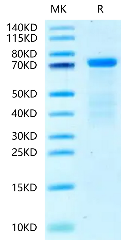 Human HRG on Tris-Bis PAGE under reduced condition. The purity is greater than 95%.Recombinant Human HRG/HPRG-Protein