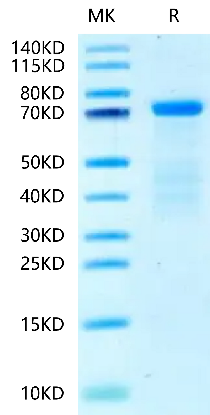 Human HRG on Tris-Bis PAGE under reduced condition. The purity is greater than 95%.Recombinant Human HRG/HPRG-Protein