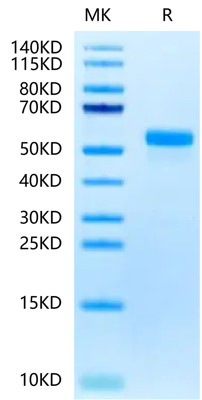 Biotinylated Human DLL3 on Tris-Bis PAGE under reduced condition. The purity is greater than 95%.Biotinylated Human DLL3 Protein (Primary Amine Labeling), Active