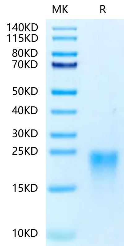 Human BAFFR on Tris-Bis PAGE under reduced conditions. The purity is greater than 95%.Recombinant Human BAFFR/TNFRSF13C Protein, Active