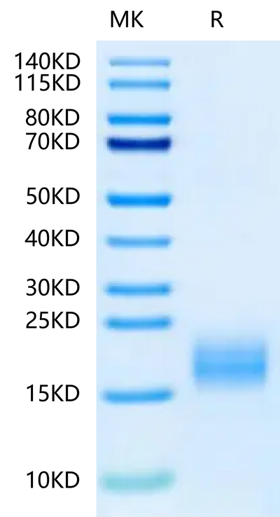 Human Fibronectin (1266-1356) on Tris-Bis PAGE under reduced condition. The purity is greater than 95%.Recombinant Human Fibronectin (1266-1356) Protein