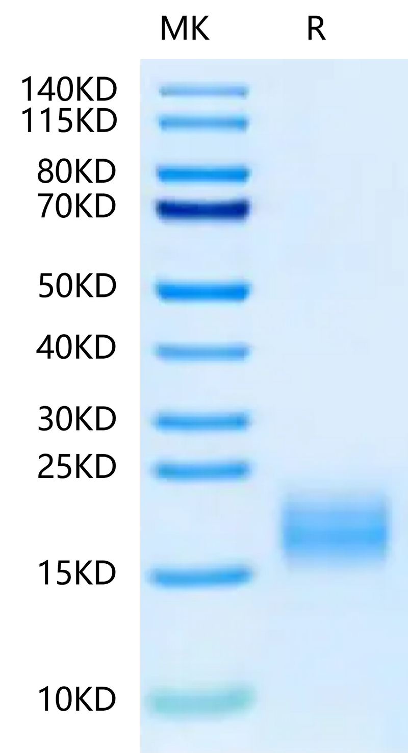 Human Fibronectin (1266-1356) on Tris-Bis PAGE under reduced condition. The purity is greater than 95%.Recombinant Human Fibronectin (1266-1356) Protein