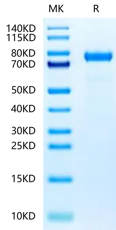 Rat Coagulation Factor II on Tris-Bis PAGE under reduced condition. The purity is greater than 95%.Recombinant Rat Coagulation Factor II-Protein