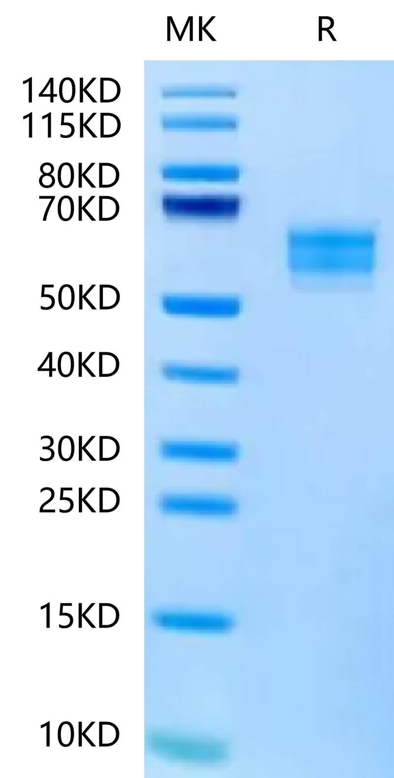 FITC-Labeled Human NKG2D on Tris-Bis PAGE under reduced condition. The purity is greater than 95%.Recombinant FITC-Labeled Human NKG2D/CD314 Protein