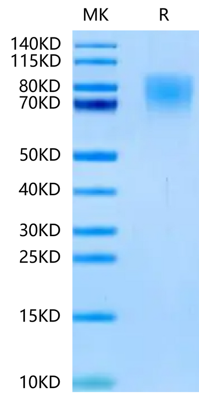 Human TrkA-on Tris-Bis PAGE under reduced condition. The purity is greater than 95%.Recombinant Human TrkA-Protein