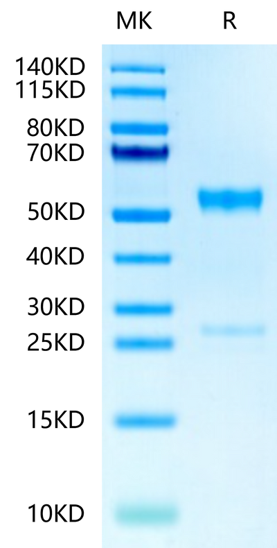Human MMP-8 on Tris-Bis PAGE under reduced condition. The purity is greater than 95%.Recombinant Human MMP-8 Protein, Active