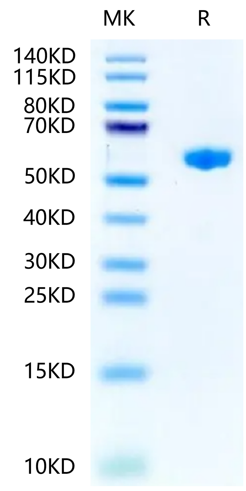 Mouse H-2K (b) &B2M&OVA (SIINFEKL) Monomer on Tris-Bis PAGE under reduced condition. The purity is greater than 95%.Recombinant Mouse H-2K(b)&B2M&OVA (SIINFEKL) Monomer Protein