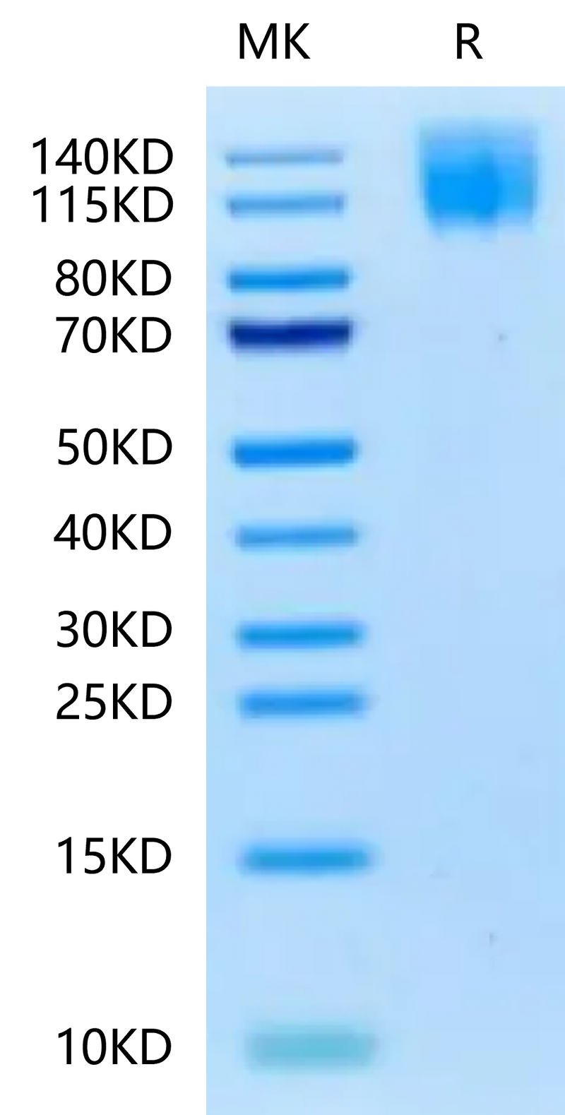 Biotinylated Human CEACAM-5 on Tris-Bis PAGE under reduced condition. The purity is greater than 95%.Biotinylated Human CEACAM-5/CD66e Protein, Active