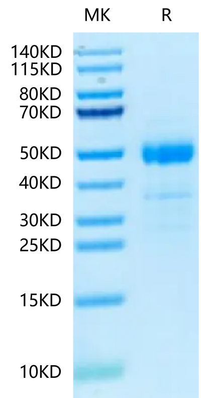 Human ST3GAL4 on Tris-Bis PAGE under reduced condition. The purity is greater than 95%.Recombinant Human ST3GAL4 Protein