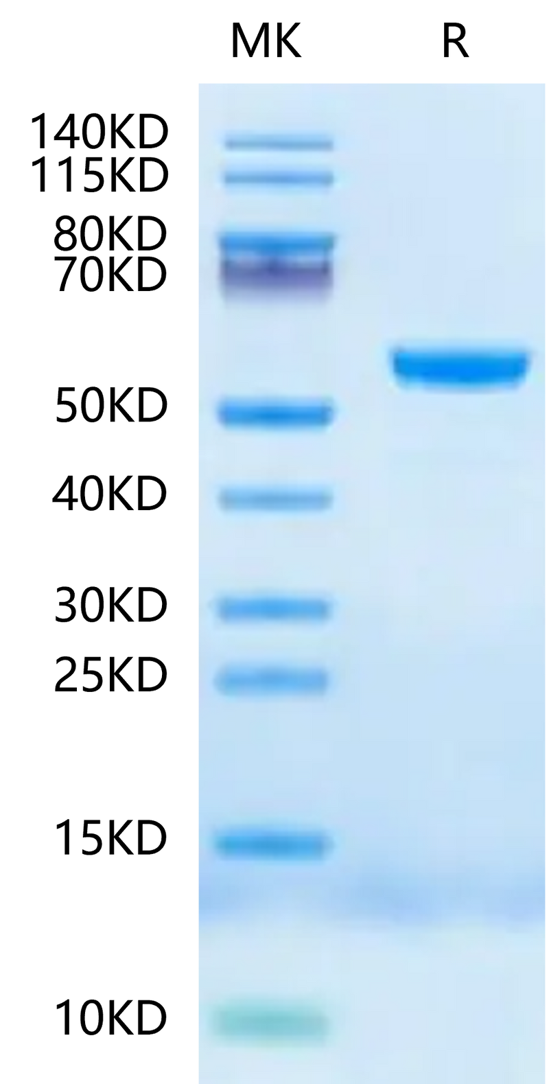 Human HLA-E*01:03&B2M&Peptide (VMAPKTLVL) Monomer Negative Control on Tris-Bis PAGE under reduced condition. The purity is greater than 95%.Recombinant Human HLA-E*01:03&B2M&Peptide (VMAPKTLVL) Monomer Negative Control Protein