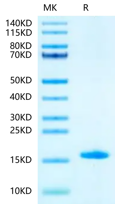 Mouse LY6A on Tris-Bis PAGE under reduced condition. The purity is greater than 95%.Recombinant Mouse LY6A-Protein
