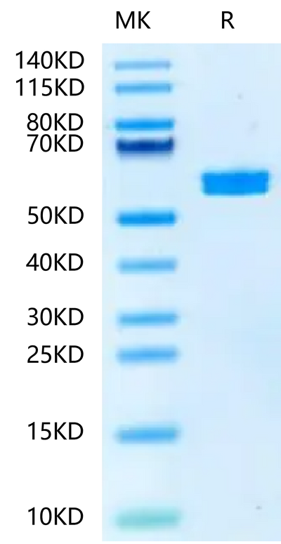 Mouse PKM2 on Tris-Bis PAGE under reduced condition. The purity is greater than 95%.Recombinant Mouse PKM2-Protein