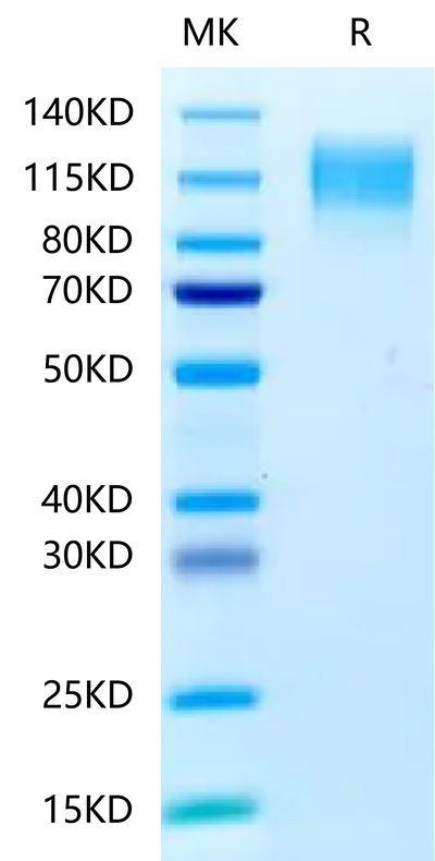 Human CEACAM-5 on Tris-Bis PAGE under reduced condition. The purity is greater than 95%.Recombinant Human CEACAM-5/CD66e Protein, Active