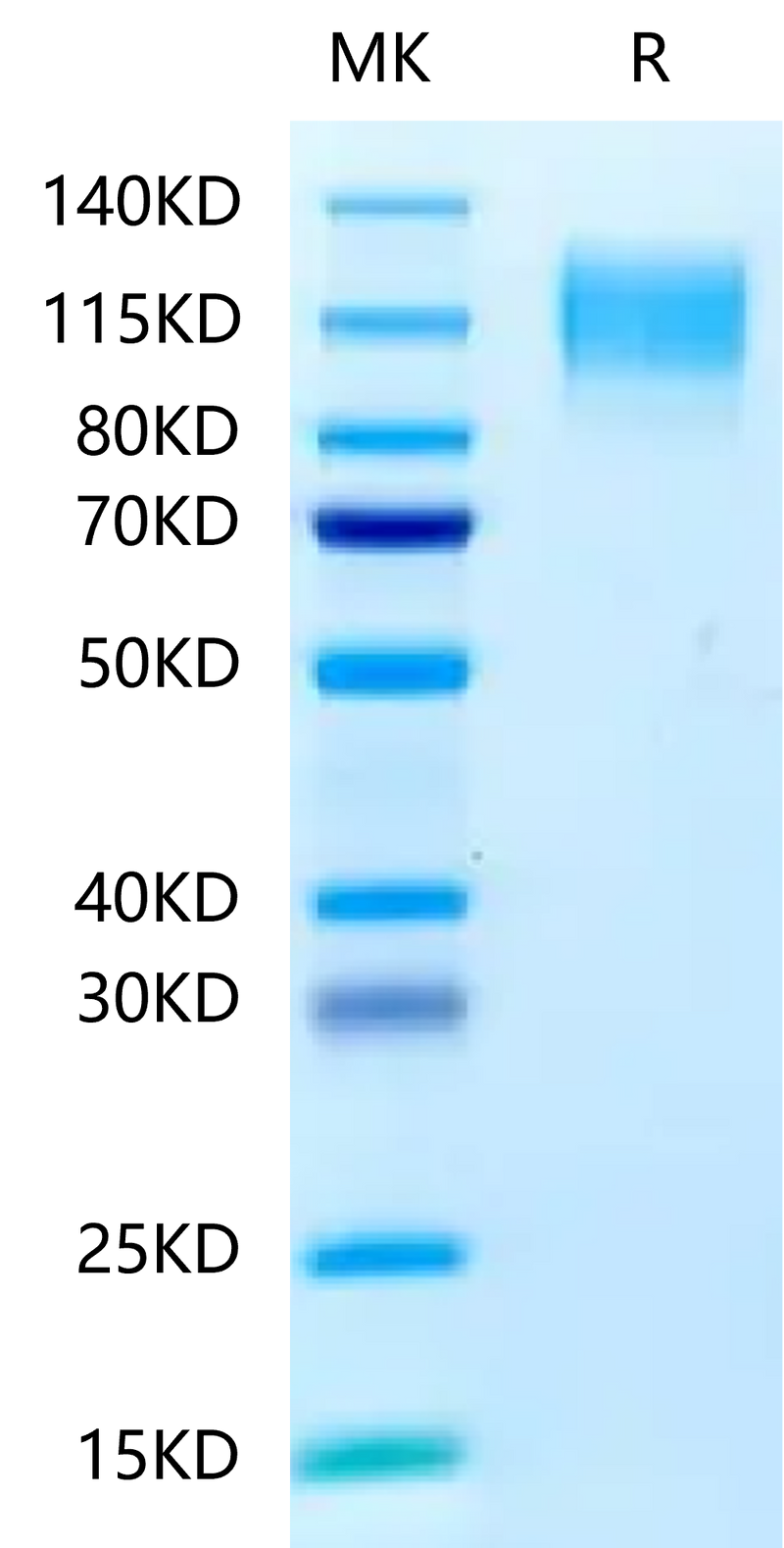 Human CEACAM-5 on Tris-Bis PAGE under reduced condition. The purity is greater than 95%.Recombinant Human CEACAM-5/CD66e Protein, Active