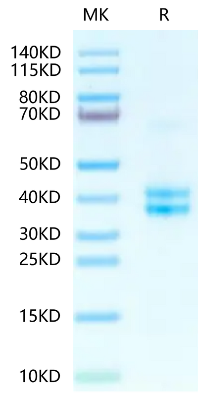 Human tPA on Tris-Bis PAGE under reduced condition. The purity is greater than 95%.Recombinant Human tPA Protein