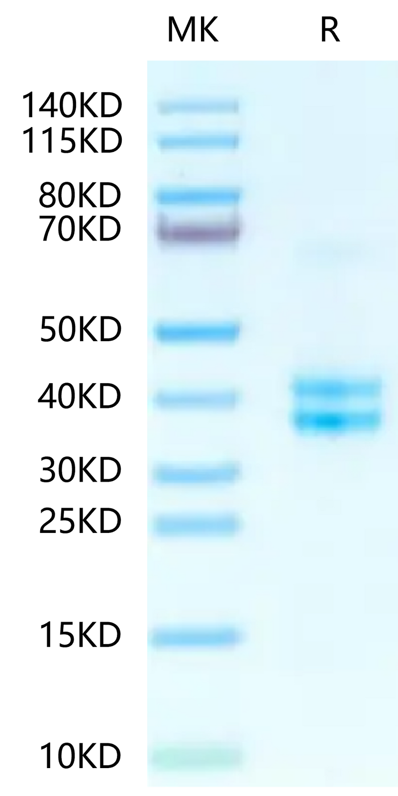 Human tPA on Tris-Bis PAGE under reduced condition. The purity is greater than 95%.Recombinant Human tPA Protein
