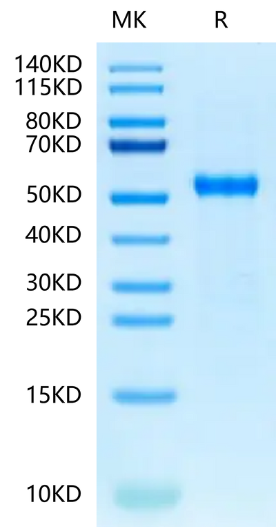 Cynomolgus DLL3 on Tris-Bis PAGE under reduced condition. The purity is greater than 95%.Recombinant Cynomolgus DLL3 Protein, Active