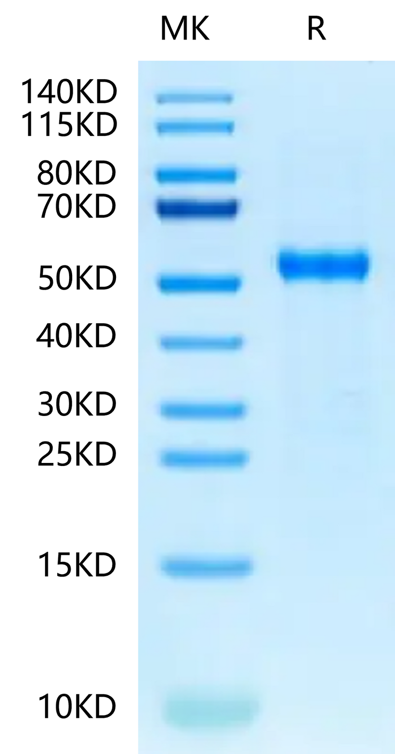 Cynomolgus DLL3 on Tris-Bis PAGE under reduced condition. The purity is greater than 95%.Recombinant Cynomolgus DLL3 Protein, Active