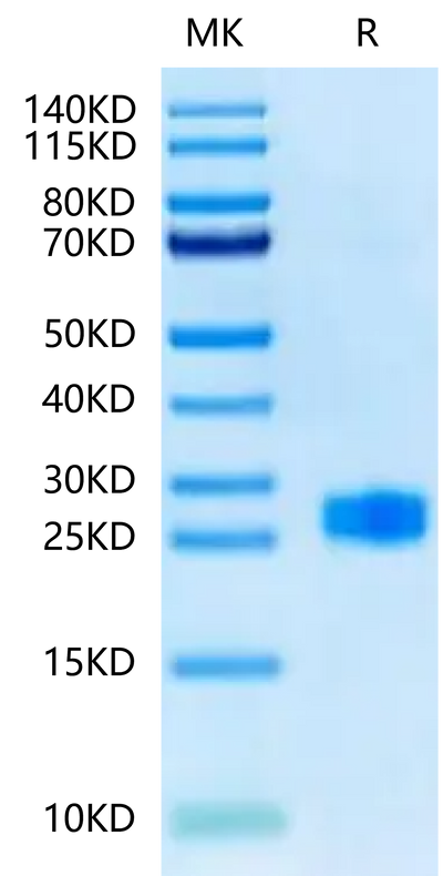 Biotinylated Human DLL3 Domain (311-479) on Tris-Bis PAGE under reduced condition. The purity is greater than 95%.Biotinylated Human DLL3 Domain (311-479) Protein, Active