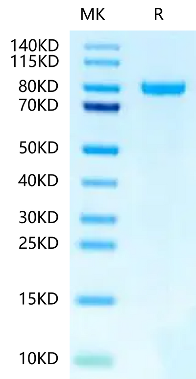 Human N Cadherin-on Tris-Bis PAGE under reduced condition. The purity is greater than 95%.Recombinant Human N Cadherin-Protein