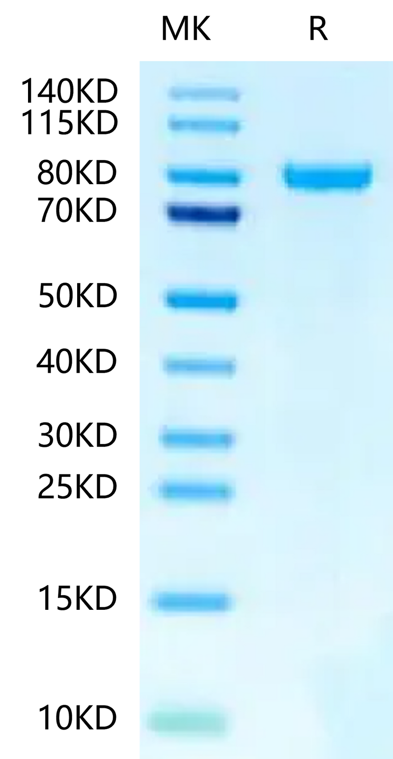 Human N Cadherin-on Tris-Bis PAGE under reduced condition. The purity is greater than 95%.Recombinant Human N Cadherin-Protein