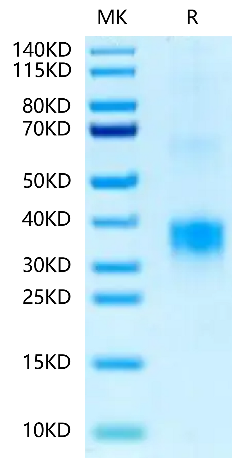 Biotinylated Human BDCA-2 on Tris-Bis PAGE under reduced condition. The purity is greater than 95%.Biotinylated Human BDCA-2 Protein, Active