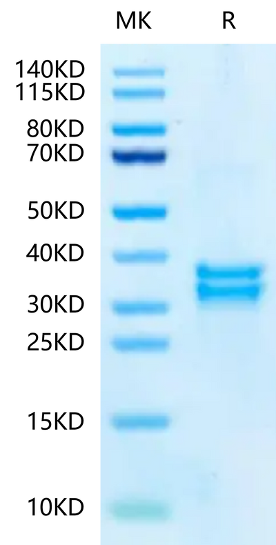 Mouse tPA on Tris-Bis PAGE under reduced condition. The purity is greater than 95%.Recombinant Mouse tPA-Protein