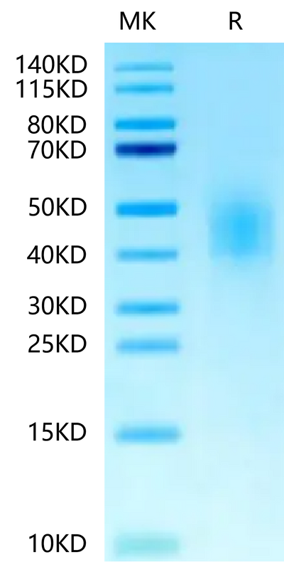 Biotinylated Human CD300A on Tris-Bis PAGE under reduced condition. The purity is greater than 95%.Biotinylated Human CD300A Protein, Active