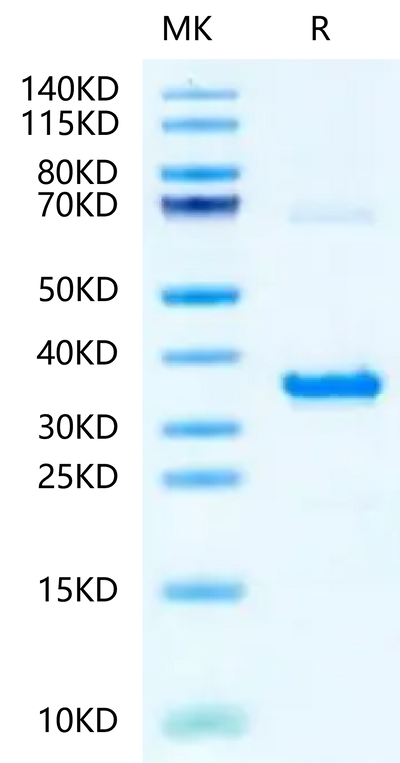 Human NMNAT1 on Tris-Bis PAGE under reduced condition. The purity is greater than 95%.Recombinant Human NMNAT1-Protein