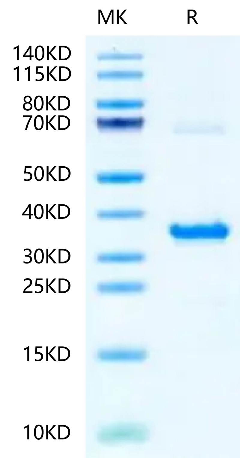 Human NMNAT1 on Tris-Bis PAGE under reduced condition. The purity is greater than 95%.Recombinant Human NMNAT1-Protein