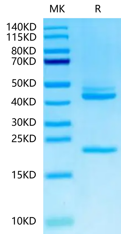 Human IL-23 alpha&IL-12 beta on Tris-Bis PAGE under reduced condition. The purity is greater than 95%.Recombinant Human IL-23 alpha&IL-12 beta Protein, Active