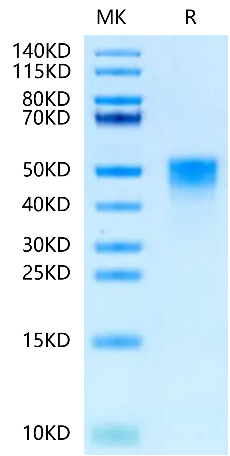 Cynomolgus TROP-2 on Tris-Bis PAGE under reduced condition. The purity is greater than 95%.Recombinant Cynomolgus TROP-2/TACSTD2 Protein, Active
