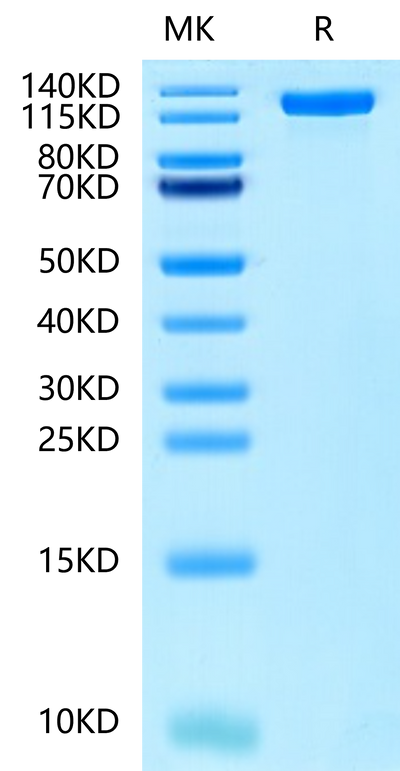 Human EGFR on Tris-Bis PAGE under reduced condition. The purity is greater than 95%.Recombinant Human EGFR/HER1 Protein, Active