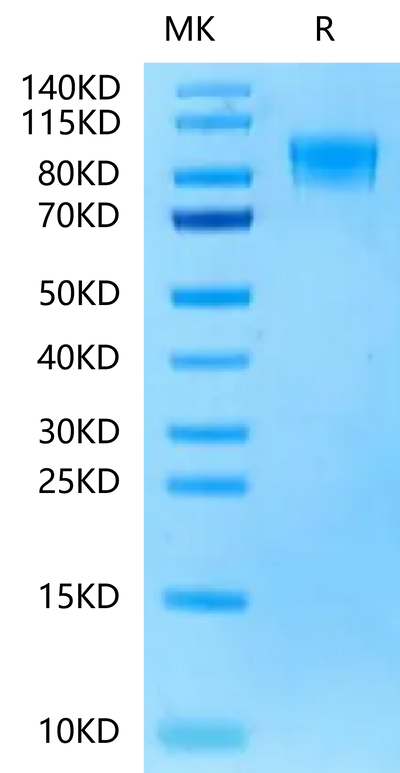 Rat PDGF R beta on Tris-Bis PAGE under reduced condition. The purity is greater than 95%.Recombinant Rat PDGF R beta/CD140b Protein, Active
